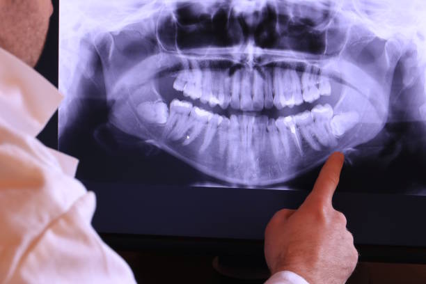 Best Emergency Dental Care for Abscessed Tooth in Hazel Crest, IL